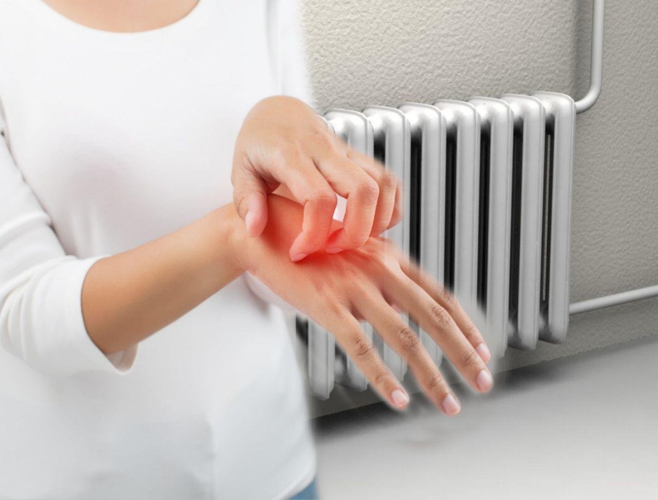 Как отопление влияет на нашу кожу? И как защитить кожу в холода?